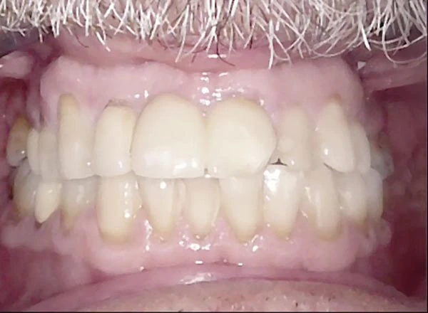 Before image