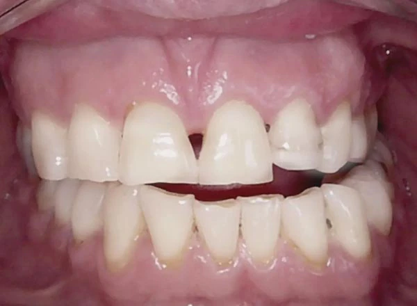 Before image